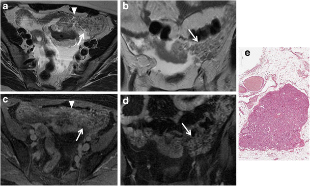 Fig. 12