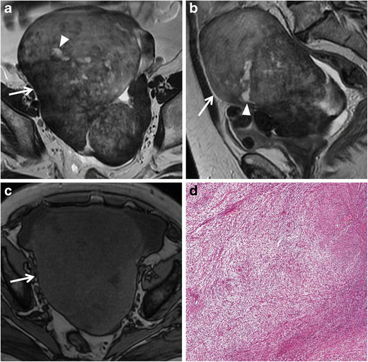 Fig. 16