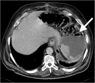 Fig. 13