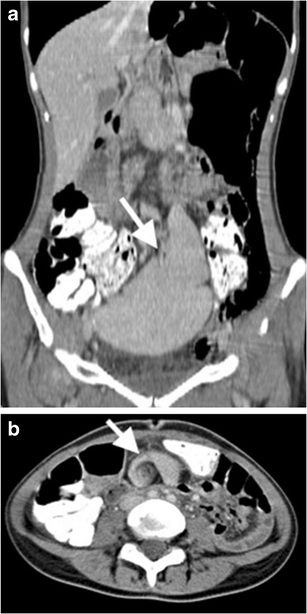 Fig. 9