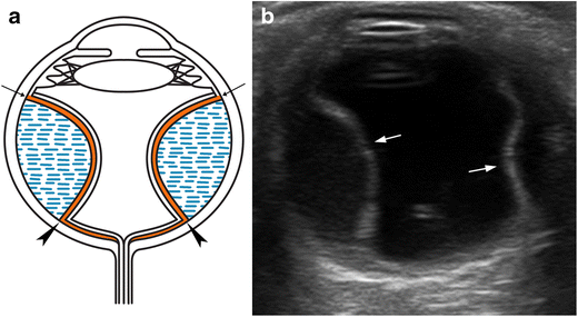 Fig. 20