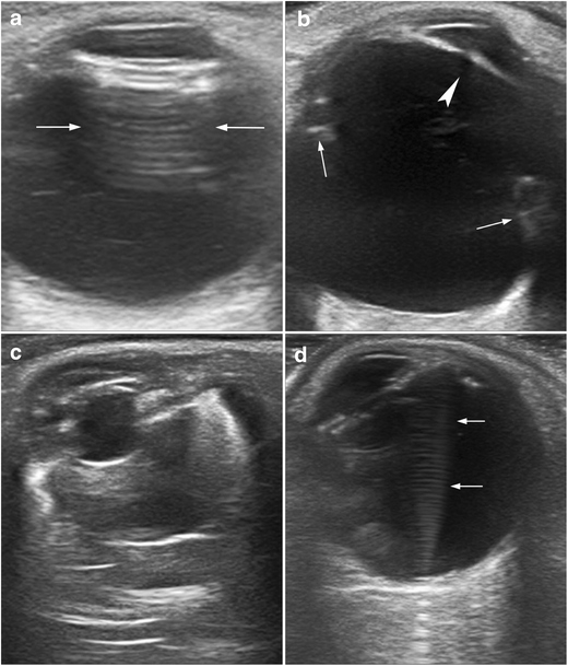 Fig. 25