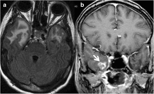 Fig. 15