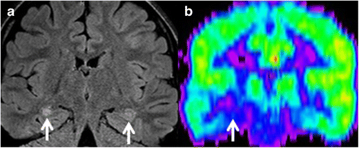 Fig. 16