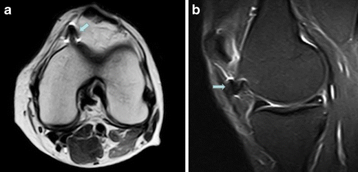 Fig. 11