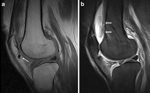 Fig. 12