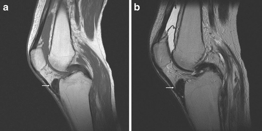 Fig. 17