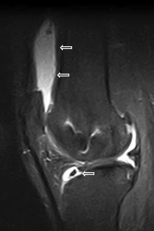 Fig. 18