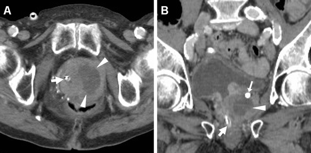 Fig. 11