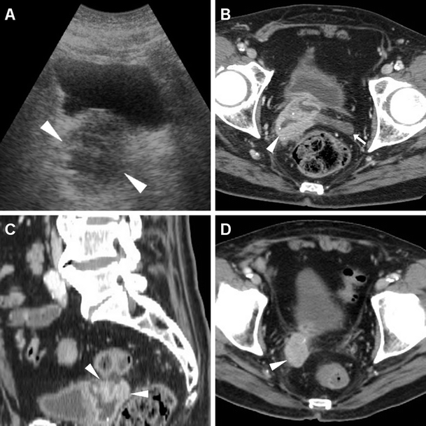 Fig. 13