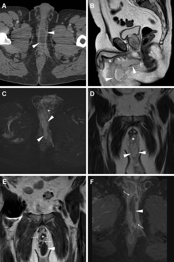 Fig. 15