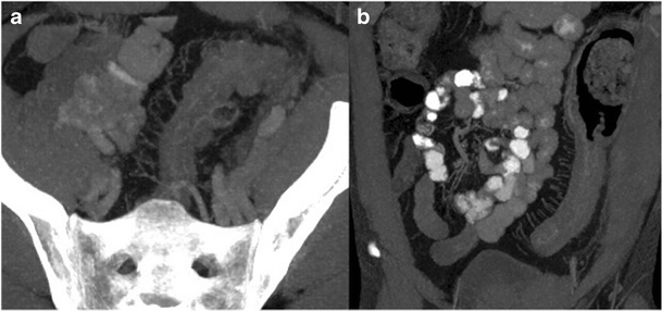 Fig. 14