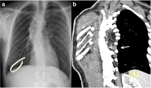 Fig. 8