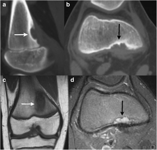 Fig. 11