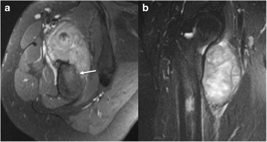 Fig. 15