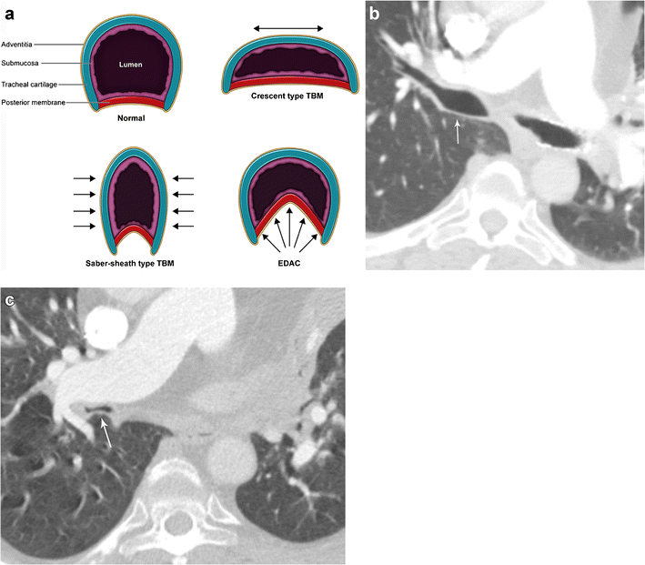 Fig. 16