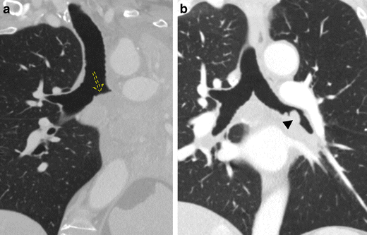 Fig. 17