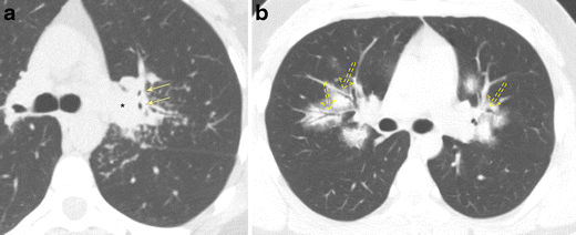 Fig. 18