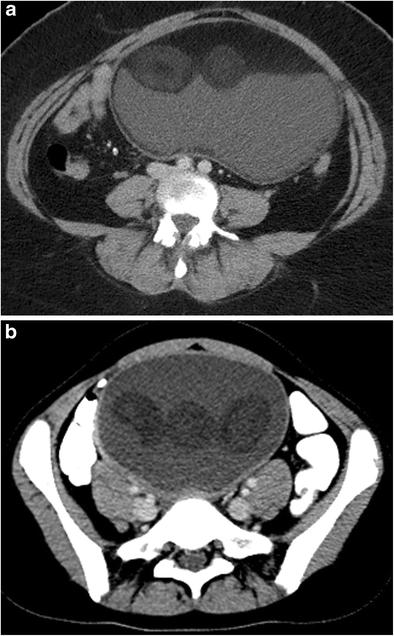 Fig. 13