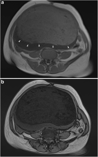 Fig. 15