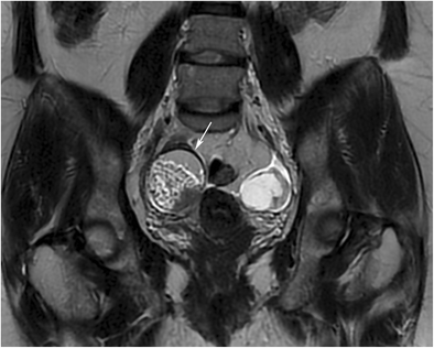 Fig. 16