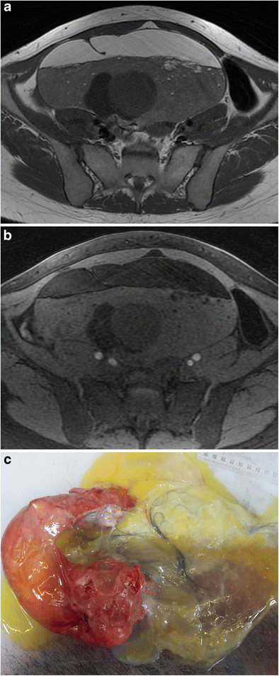 Fig. 17