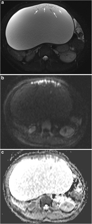 Fig. 24