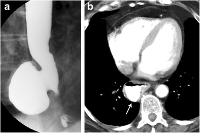 Fig. 14