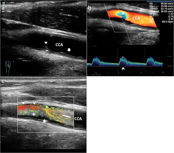 Fig. 8