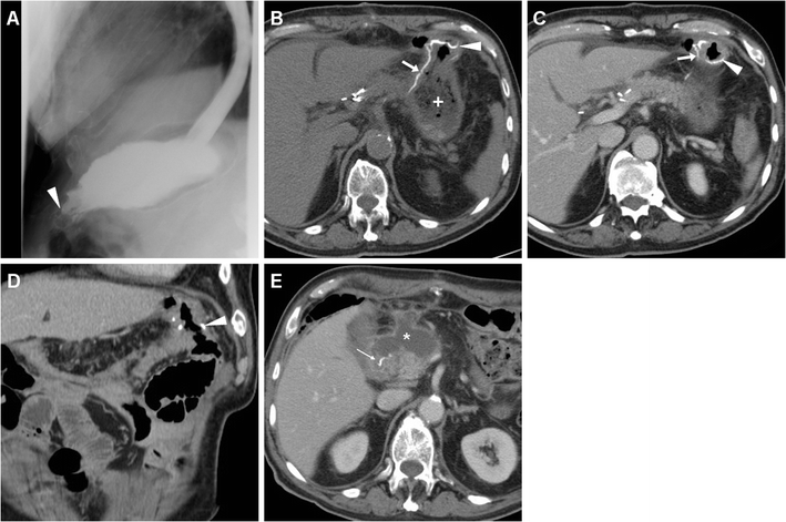 Fig. 6