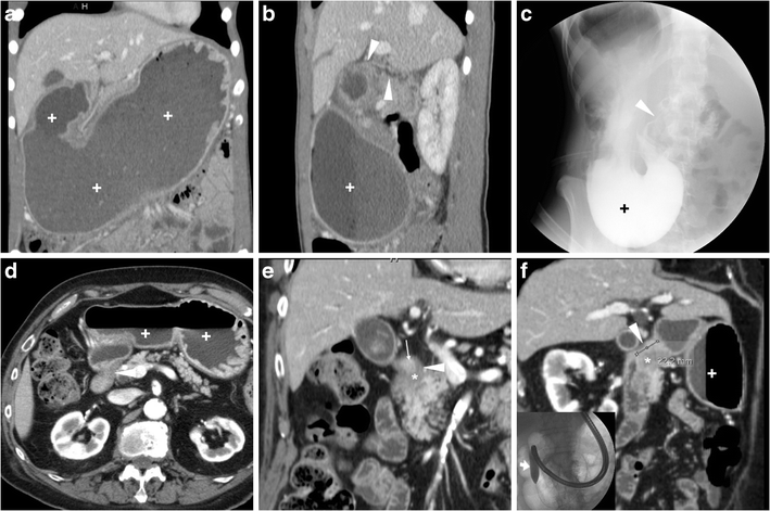 Fig. 12