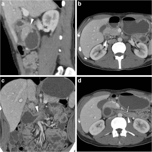 Fig. 14