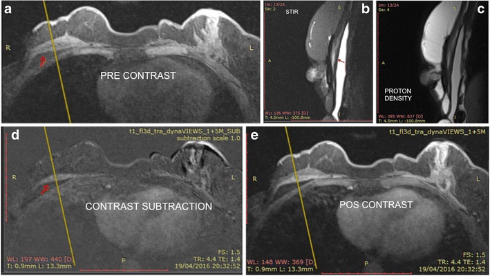 Fig. 10