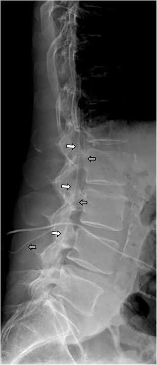 Fig. 11