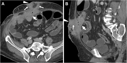 Fig. 12