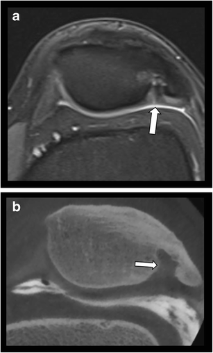 Fig. 13