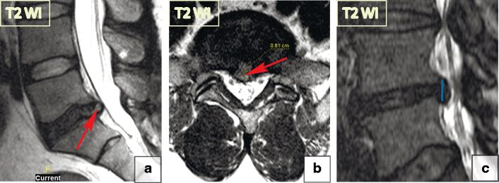 Fig. 13