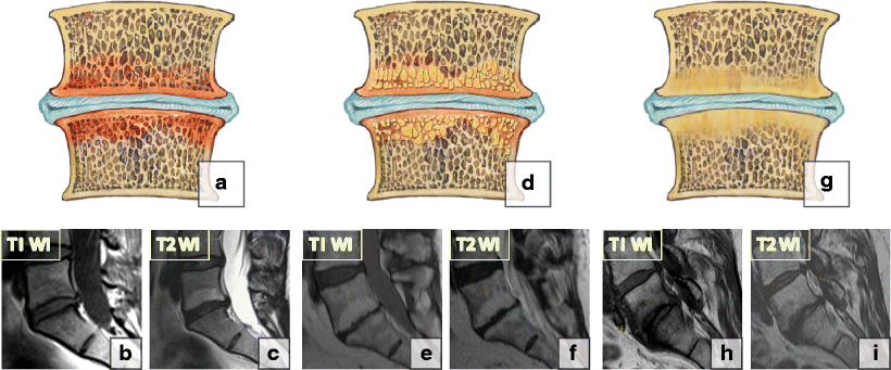 Fig. 17