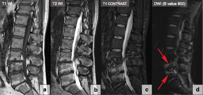 Fig. 18