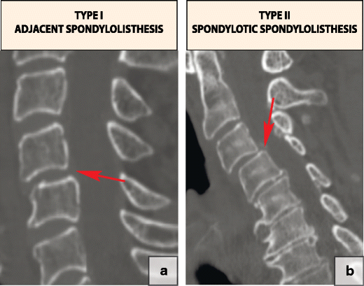 Fig. 21