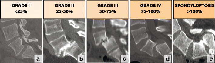 Fig. 22