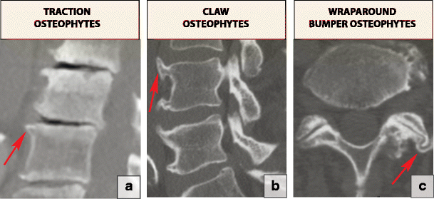 Fig. 23