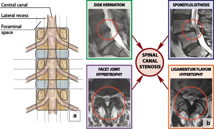 Fig. 27