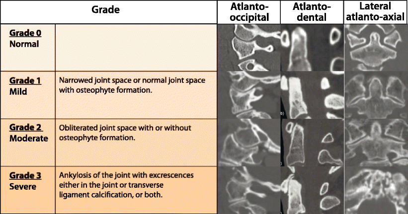 Fig. 30