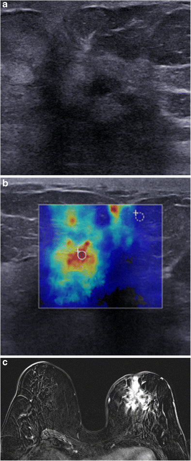 Fig. 17