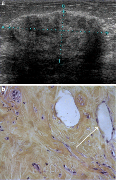 Fig. 9