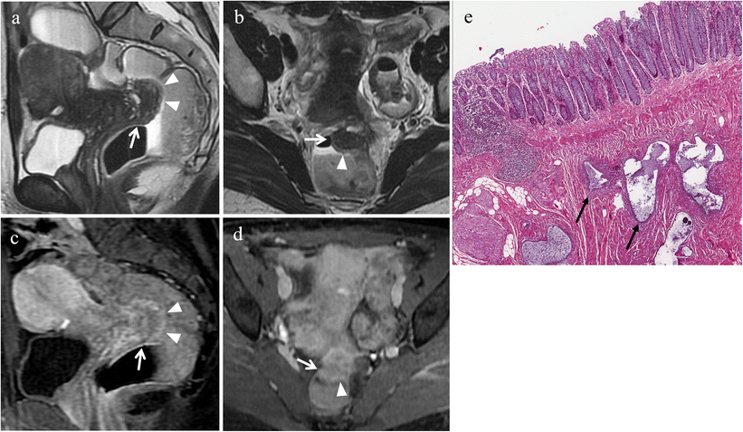 Fig. 20