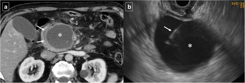 Fig. 14