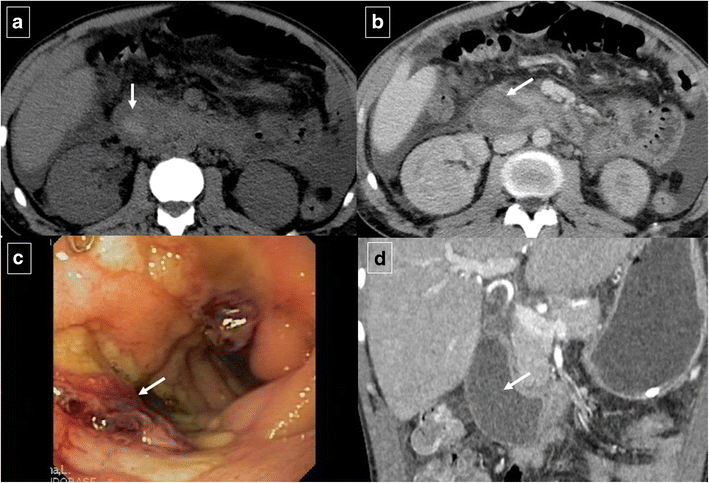 Fig. 22