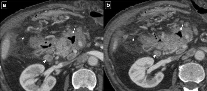 Fig. 9